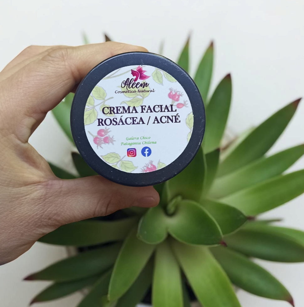 Crema Acne y Rosacea Natural 100g